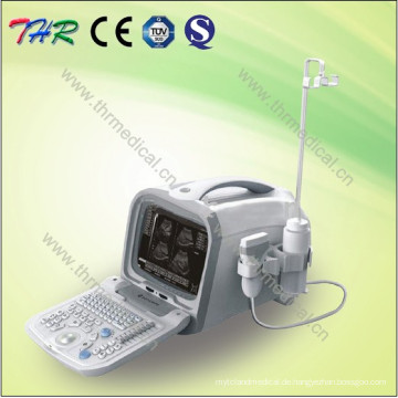 Tragbares Ultraschallgerät für Krankenhäuser (THR-US6602)